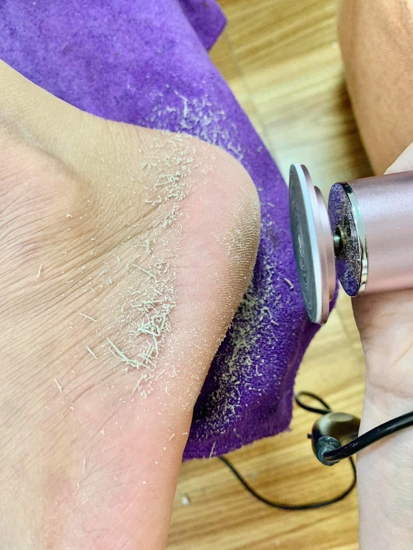 foot callus remover